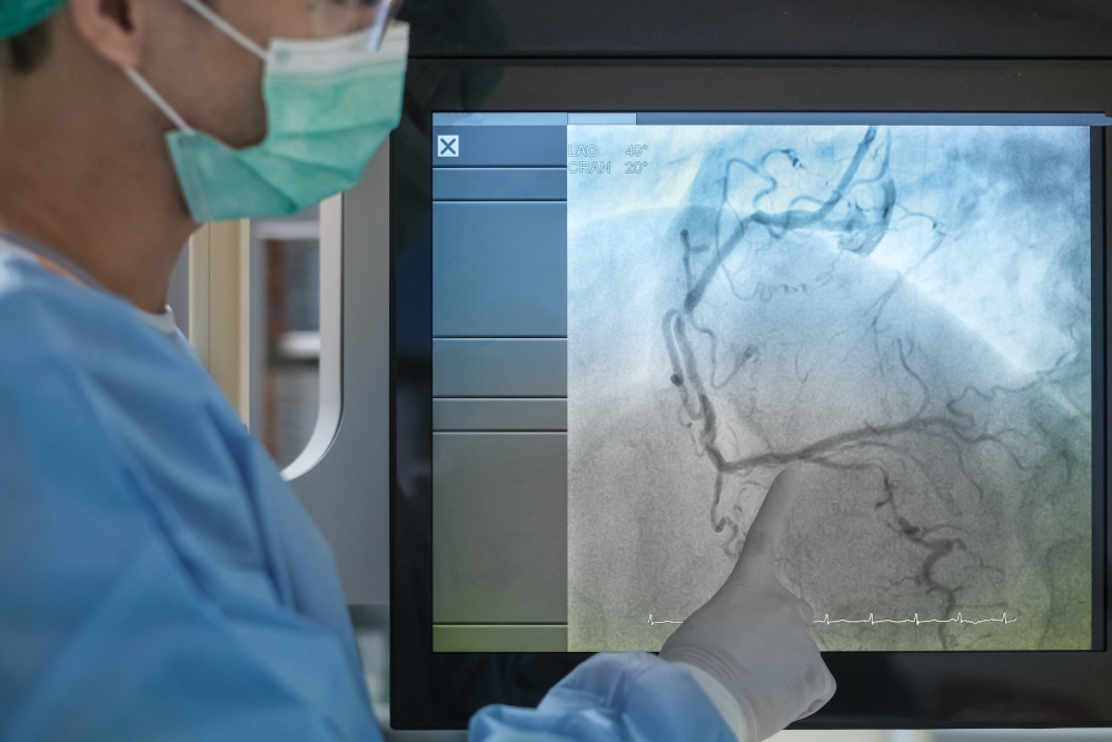 Coronary angiogram